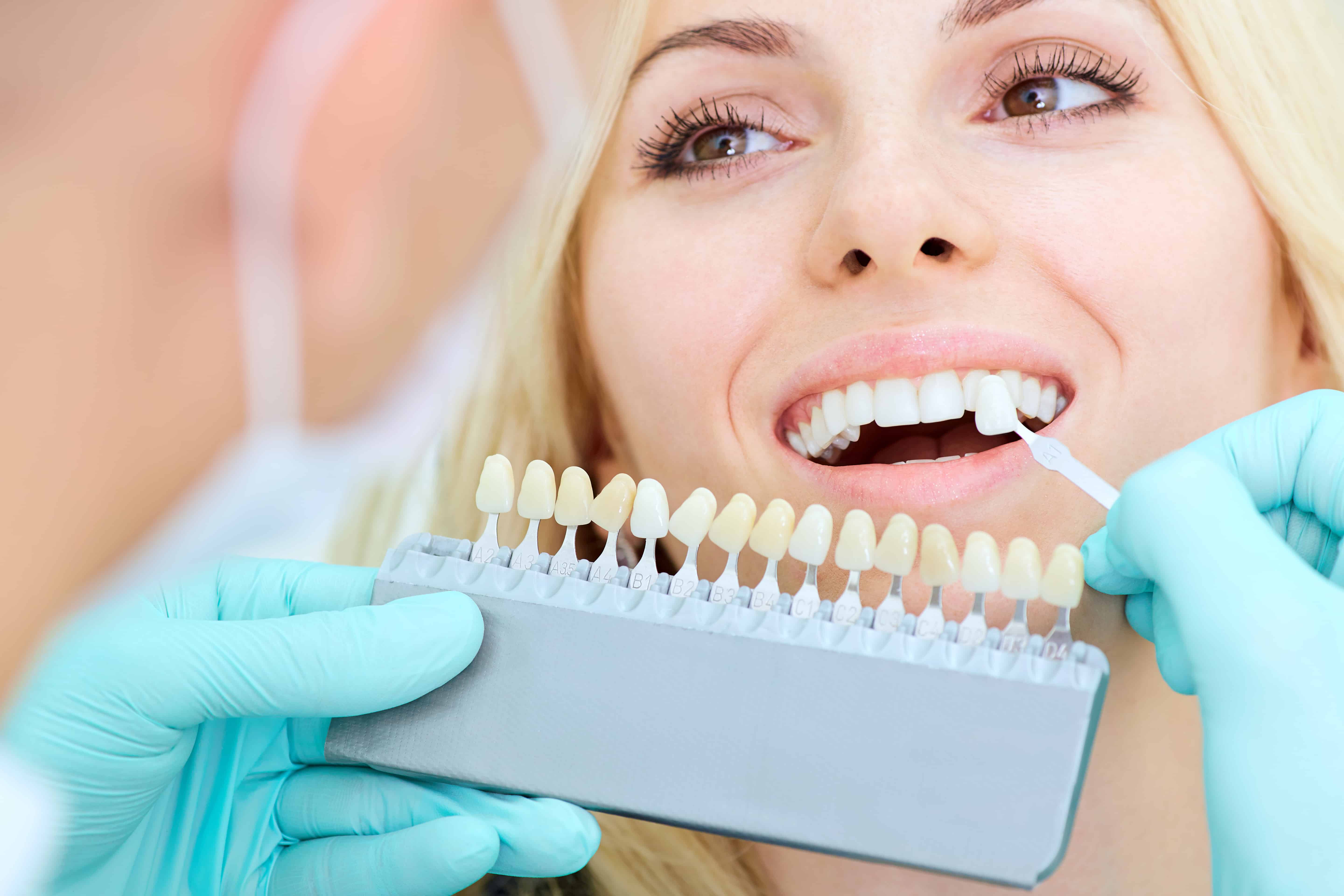 Ортопедический этап лечения. Отбеливание зубов. Красивые зубы. Красивые зубы стоматология.